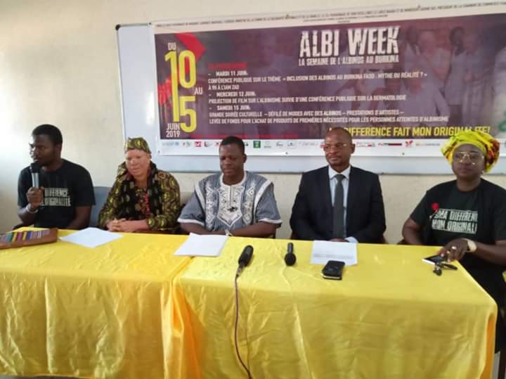 ALBI WEEK 2019: Défilé de mode des albinos et soirée culturelle également au programme.